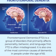 Featured Image Frontotemporal Dementia