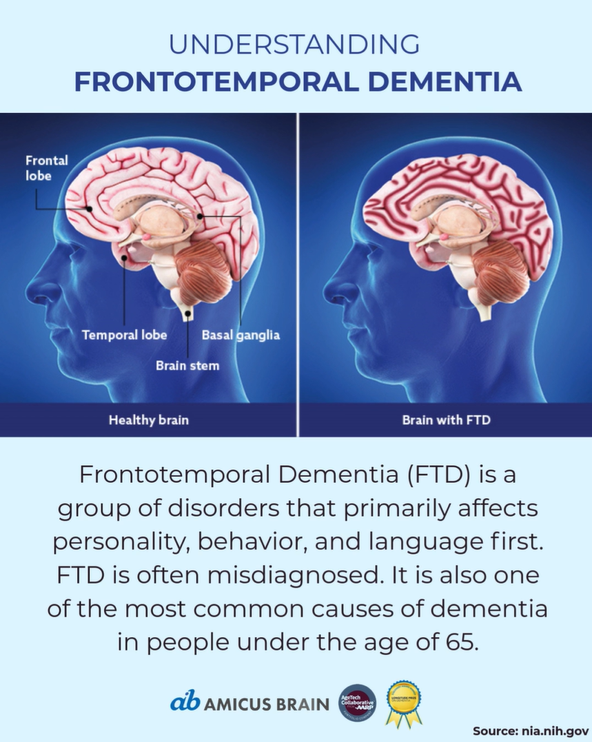Featured Image Frontotemporal Dementia